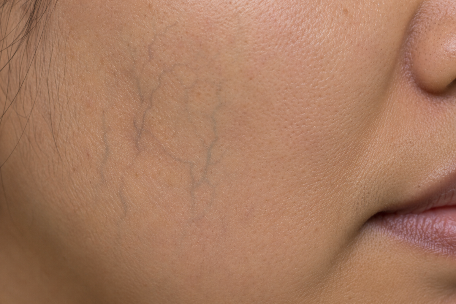 Visible Veins